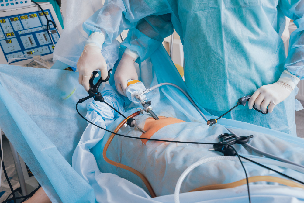 laparoscopic-surgery